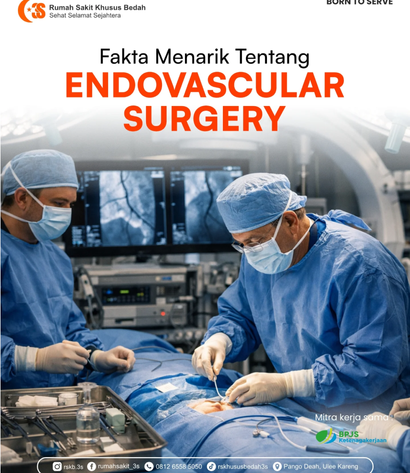 Fakta Menarik Tentang Endovascular Surgery